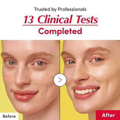 Vitamin Illuminating Dark Spot Serum